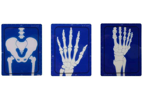 Kit médical Appareil Accessoires médicaux Radiologue